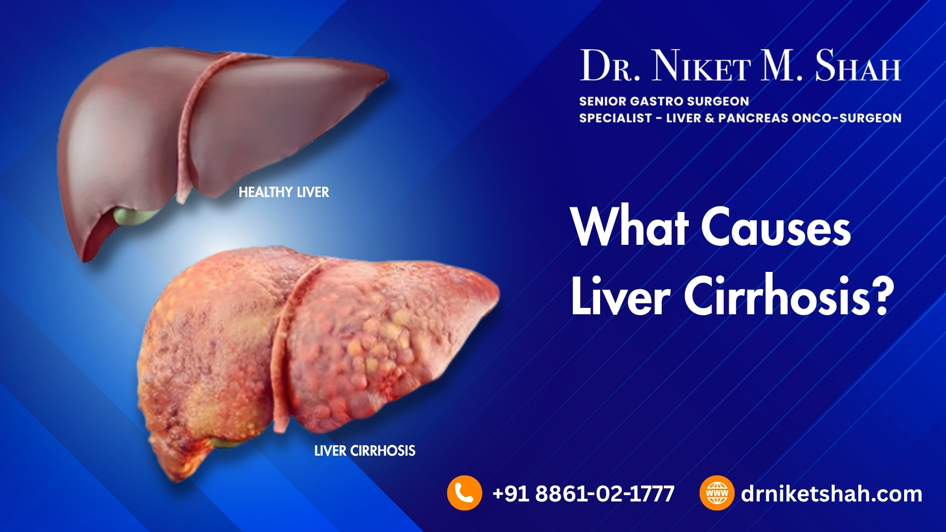 What causes liver cirrhosis?